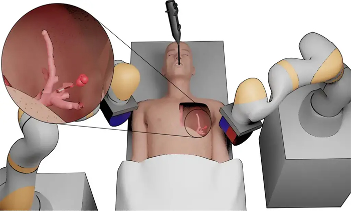  Tiny Surgical Robots Could Transform Detection And Treatment Of Cancers Details,-TeluguStop.com