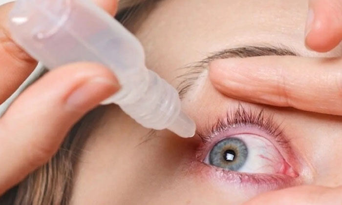 Telugu Conjunctivitis, Tips, Latest, Monsoon, Eye, Eye Symptoms-Latest News - Te