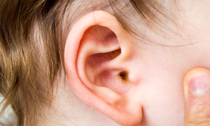 Telugu Ear Pain, Ear Wax, Tips-Telugu Health