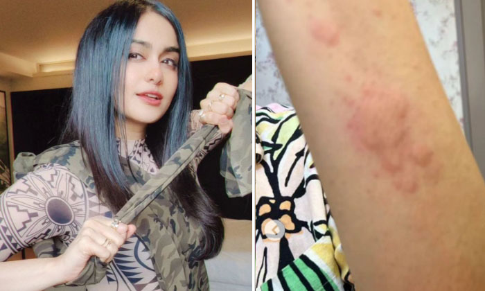  Adasharma Is Suffering From That Problem Are The Worried Fans-TeluguStop.com