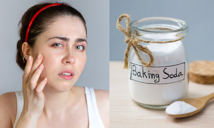  Baking Soda Treatment For Skin Problems Details, Baking Soda , Skin Problems, Bl-TeluguStop.com