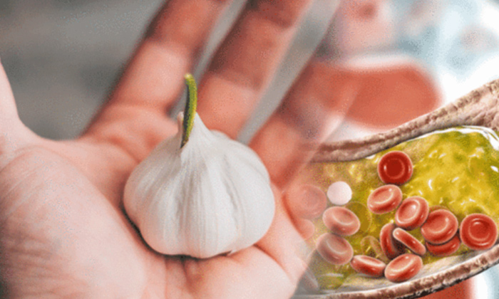  Eating Garlic To Control Cholesterol,garlic,bad Cholestrol,cholestrol,immunity P-TeluguStop.com