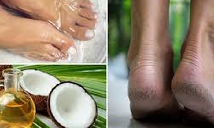 Telugu Cracked Feet, Cracked Heels, Care, Tips, Homemade Cream, Latest-Telugu He