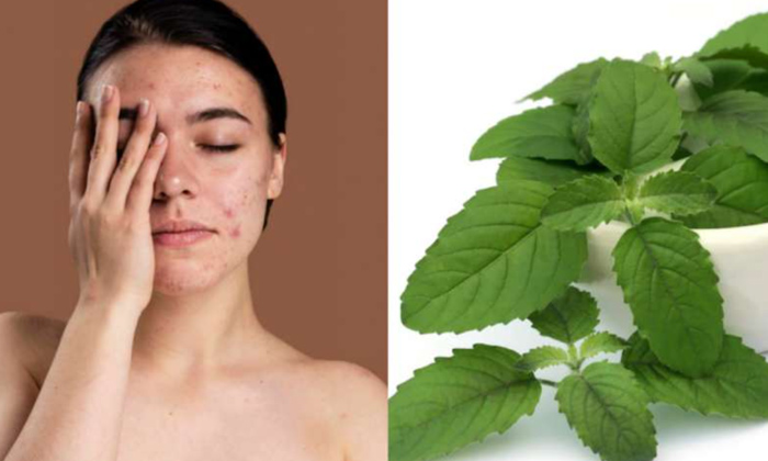  Homemade Basil Face Cream For Avoiding Acne!, Anti Acne Cream, Basil Face Cream,-TeluguStop.com