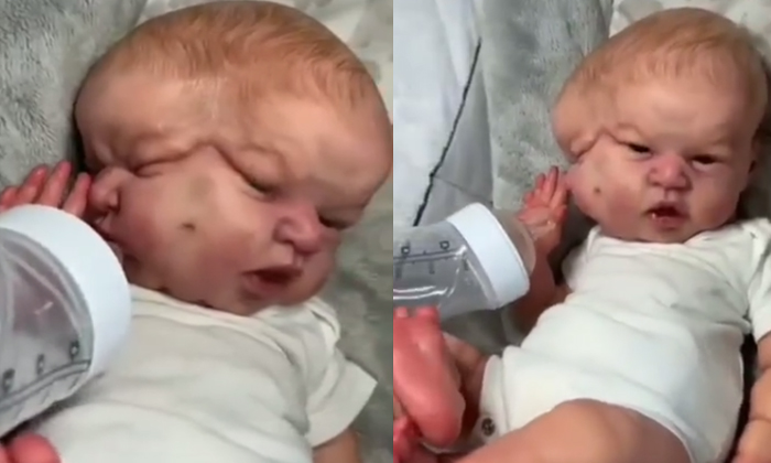  Baby Born With Two Heads Shocking Video Viral Details, Two Heads, Boy Born, Late-TeluguStop.com