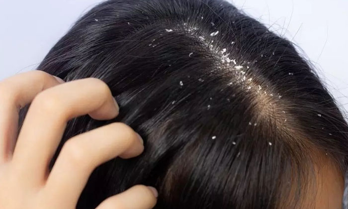  Amazing Benefits Of Washing Hair With Buttermilk! Buttermilk, Buttermilk Benefit-TeluguStop.com
