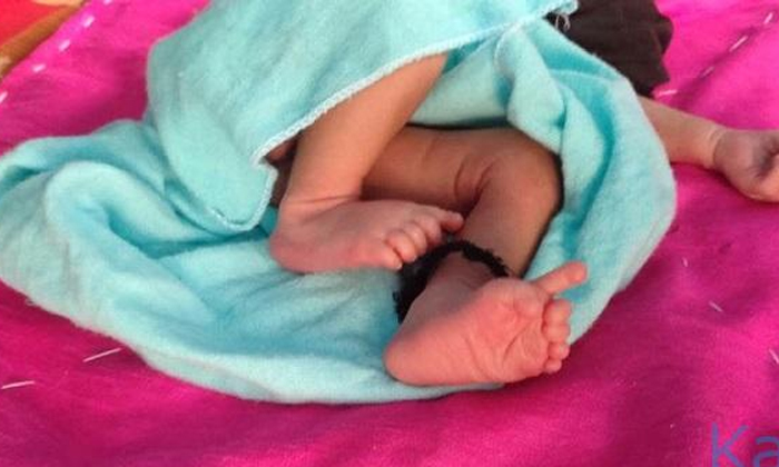  A Girl Born With 26 Fingers Details Here Goes Viral In Social Media , Sarju Devi-TeluguStop.com