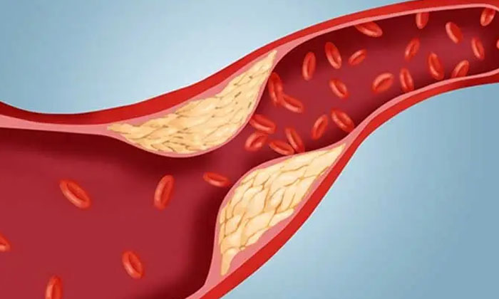 Telugu Cholesterol, Flavonoids, Halwa Papaya, Benefits, Tips, Papaya Fruit, Stom