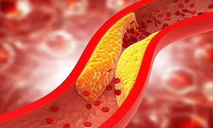 Telugu Cholesterol, Green, Tips, Latest-Telugu Health