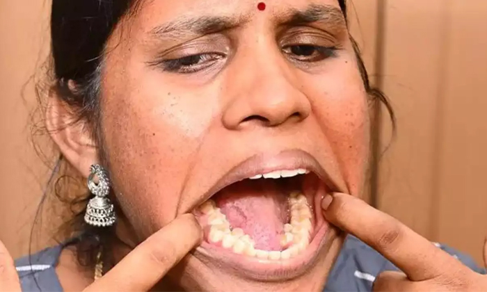  Indian Woman Kalpana Balan With 38 Teeth Sets Guinness World Record Details, Kal-TeluguStop.com