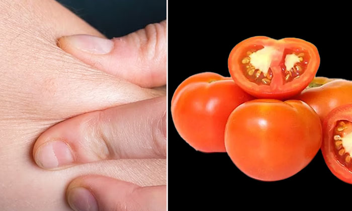  Health Benefits Of Eating Tomatoes During Winter! Tomatoes, Tomatoes Health Bene-TeluguStop.com