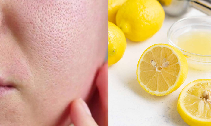  Wonderful Home Remedy To Get Rid Of Open Pores Details! Home Remedy, Open Pores,-TeluguStop.com