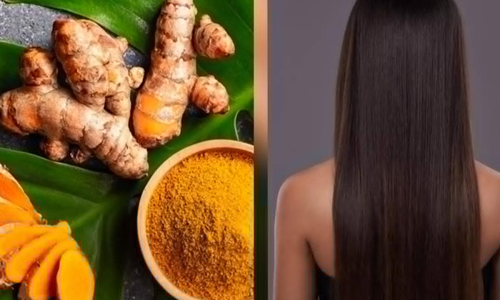 Telugu Dandruff, Dandruffremoval, Care, Care Tips, Healthy Scalp, Remedy, Latest