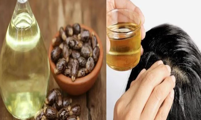 Telugu Dandruff, Dandruffremoval, Care, Care Tips, Healthy Scalp, Remedy, Latest