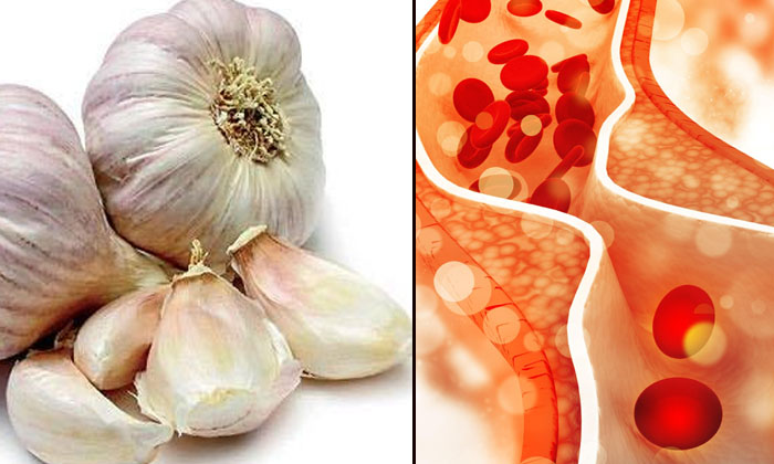  Do You Know The Benefits Of Taking Garlic In The Morning On An Empty Stomach-TeluguStop.com