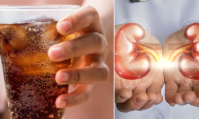  These Are The Food Items That Seriously Damage The Kidneys In Many People-TeluguStop.com