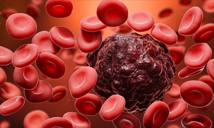  What Are The Symptoms Of Blood Cancer-TeluguStop.com