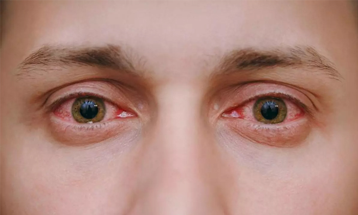  Did You Know Red Eye In Photos-TeluguStop.com