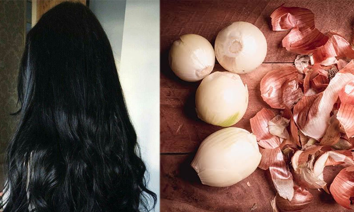  How To Make Hair Growth Serum With Onion Peel-TeluguStop.com