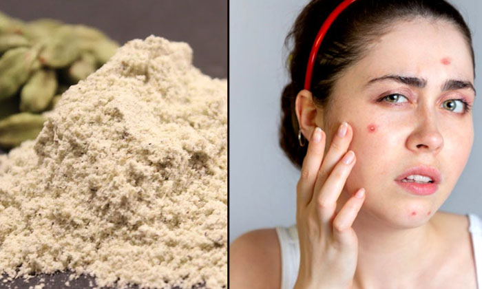  Try This Cardamom Face Mask To Get Rid Of Acne And Scars-TeluguStop.com