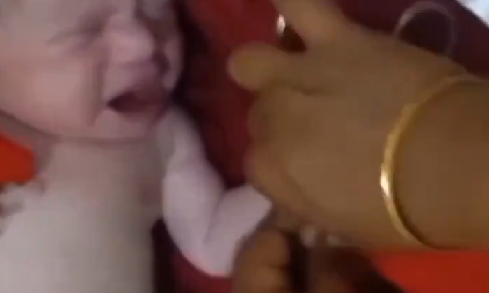  New Born Baby Caught Surgical Scissors Video Viral,surgical Scissors,social Medi-TeluguStop.com