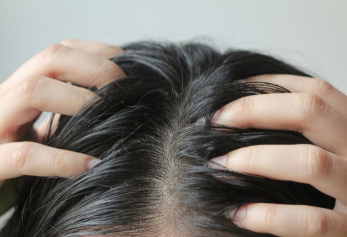  This Homemade Toner Helps To Get Rid Of Dandruff And Itchy Scalp! Itchy Scalp, D-TeluguStop.com