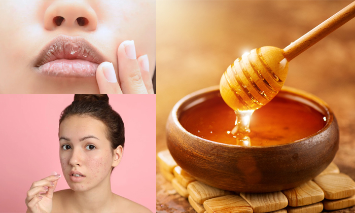  Do You Know How Many Problems Can Be Checked With Honey Details, Honey, Honey B-TeluguStop.com