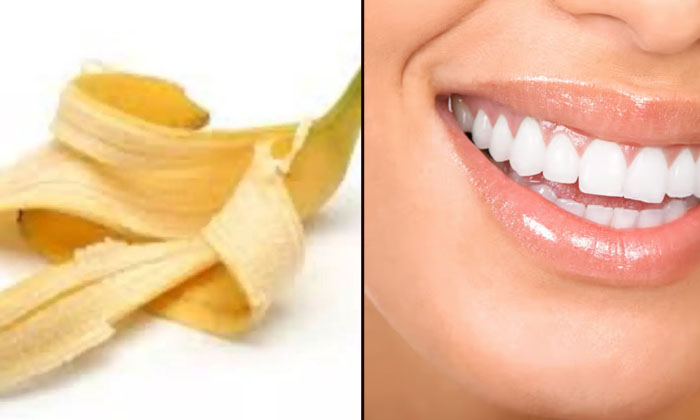  Follow These Simple Tips For White And Shiny Teeth! White Teeth, Shiny Teeth, La-TeluguStop.com