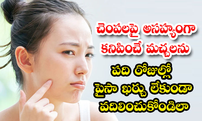 How To Get Rid Of Spots On Cheeks