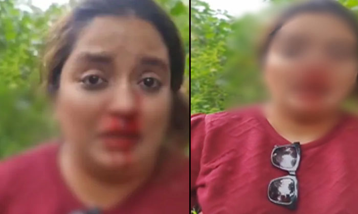  Viral Video: Atrocious The Owner Of The Car Grabbed The Woman's Hair And Beat He-TeluguStop.com