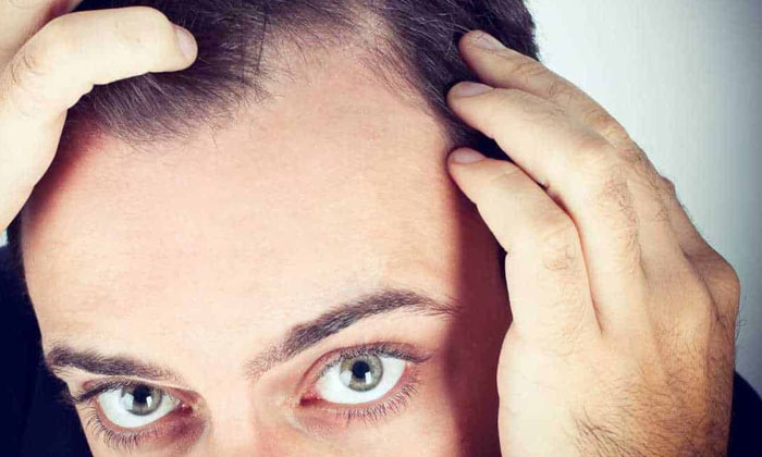  This Is The Best Tip To Prevent Hair Loss In Men! Men, Hair Loss, Hair Fall, Hai-TeluguStop.com