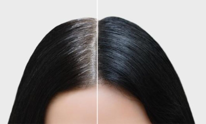  A Super Effective Remedy To Check White Hair Is For You Details, White Hair, Bl-TeluguStop.com