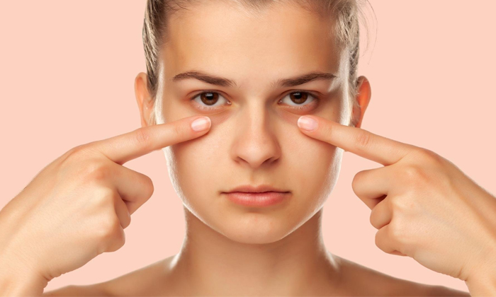  These Are The Most Effective Tips To Get Rid Of Dark Circles Details, Dark Circ-TeluguStop.com