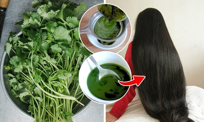  This Coriander Leaves Mask Helps To Get Rid Of Hair Fall Details, Hair Fall, St-TeluguStop.com