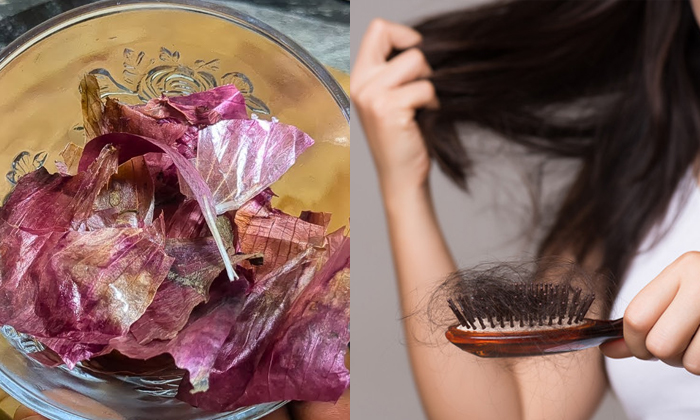  How To Use Onion Peel To Stop Hair Loss Details, Hair Loss, Hair Fall, Stop Hai-TeluguStop.com