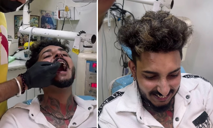  Man Gets His Natural Teeth Removed For Gold Teeth With His Name Inscribed Video-TeluguStop.com