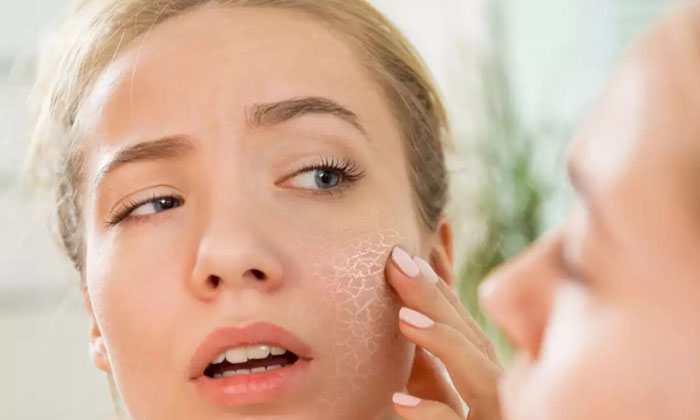  Repair Your Skin With These Simple Remedies! Simple Remedies, Skin Care, Skin Ca-TeluguStop.com