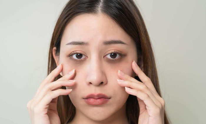  This Simple Remedy Helps To Get Rid Of Dark Circles And Dark Spots! Dark Circles-TeluguStop.com