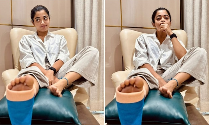 Telugu Leg Injury, Pain, Pushpa, Rashmika, Rashmika Pushpa, Tollywood-Movie