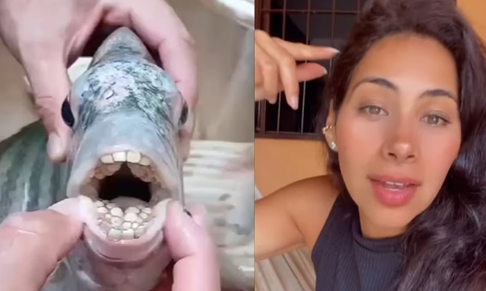  A Young Woman Ran After Seeing Human Teeth In A Fish's Mouth!, Fish, Teeth, Vira-TeluguStop.com