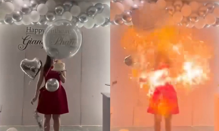 Hydrogen Balloons Explode On Woman Face During Birthday Celebration Video Viral Hydrogen Balloons Explode On Woman Face During Birthday Celebration Video Viral-TeluguStop.com