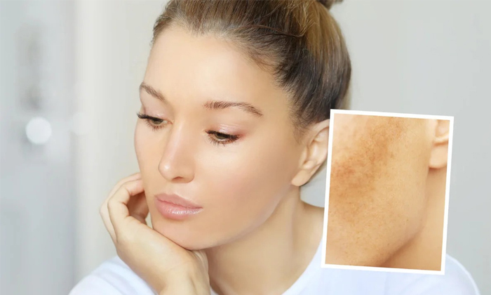These Are Powerful Home Remedies That Give You Flawless Skin Details, Flawless These Are Powerful Home Remedies That Give You Flawless Skin Details, Flawless-TeluguStop.com